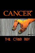 Click HERE to order CANCER, THE CRAB BOY